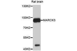 Western blot analysis of extracts of rat brain, using MARCKS antibody (ABIN4904308) at 1:1000 dilution.