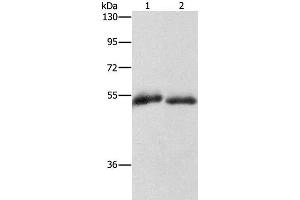 Western Blot analysis of Human placenta and fat tissue using CD36 Polyclonal Antibody at dilution of 1:1000 (CD36 antibody)