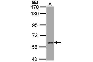 WB Image Sample (30 ug of whole cell lysate) A: Hep G2 , 7. (CBFA2T2 antibody  (C-Term))