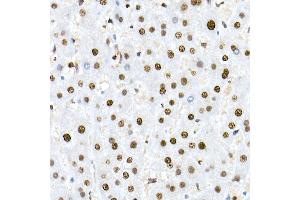 Immunohistochemistry of paraffin-embedded human liver using Nucleolin Rabbit mAb (ABIN7269035) at dilution of 1:25 (40x lens). (Nucleolin antibody)