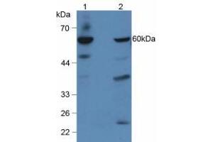 Figure. (GBA antibody  (AA 334-498))