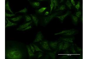 Immunofluorescence of monoclonal antibody to GFRA1 on HeLa cell. (GFRA1 antibody  (AA 32-119))