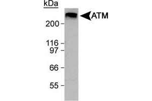 Western blot analysis of ATM in HeLa whole cell lysate using ATM polyclonal antibody .