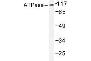 Western blot (WB) analysis of Na+/K+ ATPase alpha-1 antibody in extracts from 293 PMA 125ng/ml 30' cells. (ATP1A1 antibody)