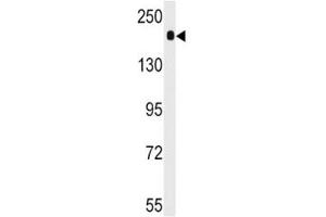 Western blot analysis of ACE antibody and mouse lung tissue lysate. (Angiotensin I Converting Enzyme 1 antibody  (AA 1274-1306))