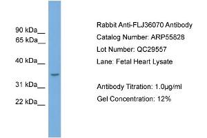 WB Suggested Anti-FLJ36070  Antibody Titration: 0. (FLJ36070 (N-Term) antibody)