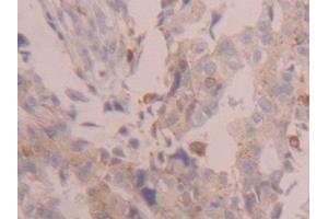 Used in DAB staining on fromalin fixed paraffin-embedded Kidney tissue (Cathepsin D antibody  (AA 23-161))