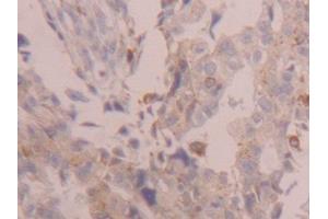 Immunohistochemistry (IHC) image for anti-Cathepsin D (CTSD) (AA 23-161) antibody (ABIN1174453)