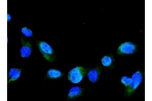 IF analysis of GRK2 using anti-GRK2 antibody (ABIN5693069). (GRK2 antibody)