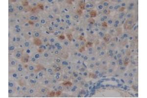 IHC-P analysis of Mouse Liver Tissue, with DAB staining. (COMP antibody  (AA 554-753))