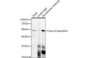 Immunoprecipitation analysis of 300 μg extracts of HeLa cells using 3 μg Glucokinase (GCK) antibody (ABIN7267396). (GCK antibody)