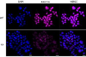 Immunocytochemical staining of Hela cells using RAD23A antibody (ABIN7800116), 1:1,000), Top panel: wild-type (WT), Bottom panal: RAD23A shRNA knockdown (KD). (Recombinant RAD23A antibody)