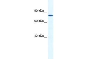 WB Suggested Anti-ZNF214 Antibody Titration:  1.