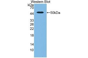 Detection of Recombinant uPA, Rat using Polyclonal Antibody to Plasminogen Activator, Urokinase (uPA) (PLAU antibody  (AA 17-432))