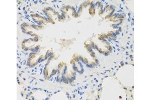Immunohistochemistry of paraffin-embedded Rat lung using TICAM1 Polyclonal Antibody at dilution of 1:100 (40x lens). (TICAM1 antibody)