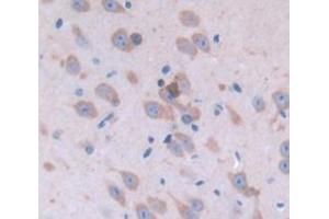 Figure. (PLTP antibody  (AA 337-479))