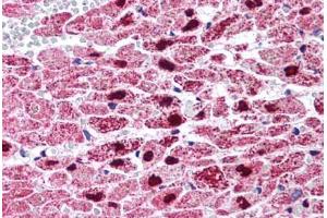 Human Heart (formalin-fixed, paraffin-embedded) stained with PPARG antibody ABIN214562 at 5 ug/ml followed by biotinylated goat anti-rabbit IgG secondary antibody ABIN481713, alkaline phosphatase-streptavidin and chromogen. (PPARG antibody  (Internal Region))