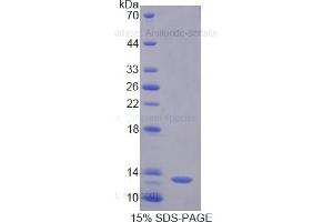 SDS-PAGE of Protein Standard from the Kit (Highly purified E. (DAO ELISA Kit)
