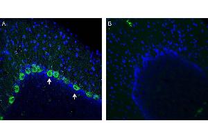 Expression of NMUR1 in rat cerebellum. (NMUR1 antibody  (Extracellular, Loop 3))