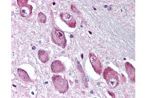 Anti-GABRA3 antibody IHC of human brain, basal nucleus of Meynert. (GABRA3 antibody  (N-Term))