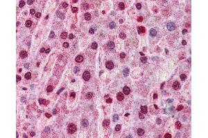Immunohistochemistry (IHC) image for anti-Hepatocyte Nuclear Factor 4, alpha (HNF4A) (Middle Region) antibody (ABIN2779763) (HNF4A antibody  (Middle Region))