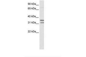 Image no. 1 for anti-NK2 Homeobox 2 (Nkx2-2) (AA 30-79) antibody (ABIN6736071)