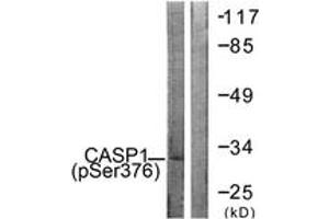 Western blot analysis of extracts from 293 cells, using Caspase 1 (Phospho-Ser376) Antibody. (Caspase 1 antibody  (pSer376))