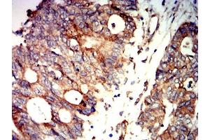 Immunohistochemistry (IHC) image for anti-Protein Kinase, AMP-Activated, beta 2 Non-Catalytic Subunit (PRKAB2) (AA 1-120) antibody (ABIN5611226)