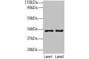 Western blot All lanes: PTDSS1 antibody at 2 μg/mL Lane 1: EC109 whole cell lysate Lane 2: 293T whole cell lysate Secondary Goat polyclonal to rabbit IgG at 1/15000 dilution Predicted band size: 56, 39, 35 kDa Observed band size: 35 kDa (PTDSS1 antibody  (AA 1-35))