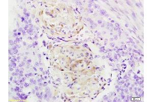 Immunohistochemistry (Paraffin-embedded Sections) (IHC (p)) image for anti-Cathepsin B (CTSB) (AA 251-339) antibody (ABIN687412)