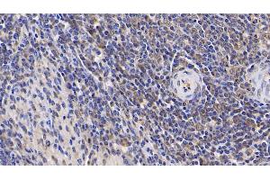 Detection of IL17RA in Human Spleen Tissue using Polyclonal Antibody to Interleukin 17 Receptor A (IL17RA) (IL17RA antibody  (AA 33-172))