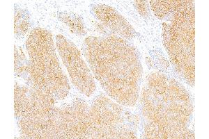 Immunohistochemistry (IHC) image for anti-Tubulin, beta (TUBB) (AA 1-50) antibody (ABIN7453995) (Recombinant TUBB antibody  (AA 1-50))