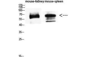 Western Blot (WB) analysis of Mouse Kidney Mouse Spleen using CD19 Polyclonal Antibody diluted at 1:1500.