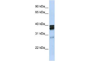 WB Suggested Anti-NUDT18 Antibody Titration:  0. (NUDT18 antibody  (N-Term))