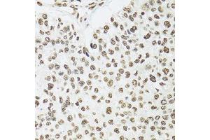 Immunohistochemistry (Paraffin-embedded Sections) (IHC (p)) image for anti-Splicing Factor Proline/glutamine-Ric (SFPQ) (AA 578-707) antibody (ABIN1513519)