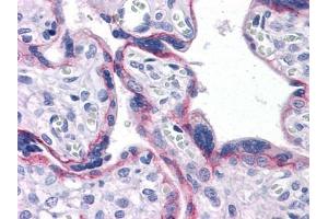 Immunohistochemical analysis of paraffin-embedded human Placenta tissues using CDH2 antibody (N-Cadherin antibody)