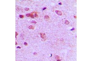 Immunohistochemical analysis of c-FER staining in human brain formalin fixed paraffin embedded tissue section. (FER antibody  (C-Term))