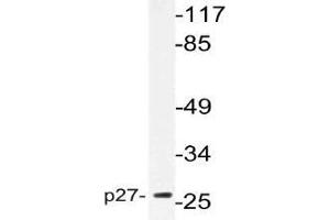 Western blot (WB) analysis of p27 antibody in extracts from NIH/3T3cells.