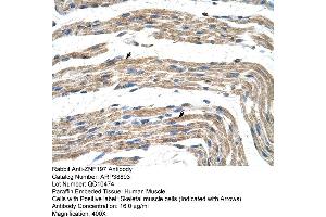 Human Muscle (ZNF197 antibody  (N-Term))