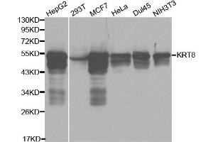 Western blot analysis of extracts of various cell lines, using KRT8 antibody (ABIN5970401) at 1/1000 dilution. (KRT8 antibody)