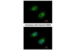 ICC/IF Image Immunofluorescence analysis of methanol-fixed HeLa, using COL3A1, antibody at 1:50 dilution. (COL3A1 antibody  (C-Term))