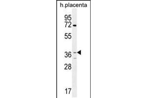 Western blot analysis in human placenta tissue lysates (35ug/lane). (OR2AT4 antibody  (C-Term))