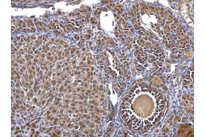 Immunohistochemistry (IHC) image for anti-Casein Kinase 2, beta (CSNK2B) antibody (ABIN2855043)