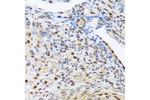 Immunohistochemistry of paraffin-embedded rat ovary using HES5 Rabbit mAb (ABIN7267559) at dilution of 1:100 (40x lens). (HES5 antibody)