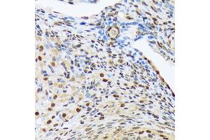 Immunohistochemistry of paraffin-embedded rat ovary using HES5 Rabbit mAb (ABIN7267559) at dilution of 1:100 (40x lens).
