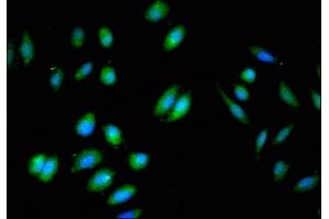 Immunofluorescent analysis of A549 cells using ABIN7145784 at dilution of 1:100 and Alexa Fluor 488-congugated AffiniPure Goat Anti-Rabbit IgG(H+L) (BIN3 antibody  (AA 8-240))
