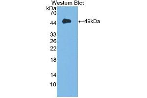 Detection of Recombinant DAG1, Mouse using Polyclonal Antibody to Dystrophin Associated Glycoprotein 1 (DAG1) (Dystroglycan antibody  (AA 28-406))