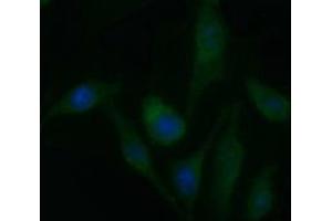 Image no. 2 for anti-Platelet Derived Growth Factor Receptor beta (PDGFRB) antibody (ABIN1500102) (PDGFRB antibody)