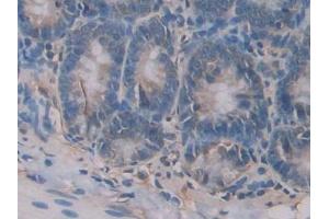 DAB staining on IHC-P; Samples: Rat Small intestine Tissue (CD42a antibody  (AA 1-161))