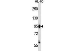 ZHX3 Antibody (C-term) western blot analysis in HL-60 cell line lysates (35 µg/lane). (ZHX3 antibody  (C-Term))